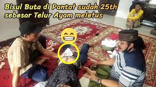 bisul buta di pantat udah 25 th sebesar telor ayam pengobatan alternatif Abah kardali Cikeusikbanten [upl. by Patience353]