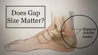 Achilles Rupture No Surgery  Does Gap Size Matter Early Rehab is best Month 35 Recovery [upl. by Enitsed]