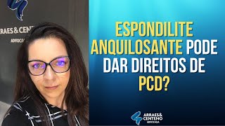 Espondilite Anquilosante dá direitos de PCD  Entenda as possibilidades [upl. by Nomyad79]