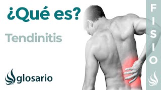 TENDINITIS  Qué es qué estructuras afecta síntomas signos causas y tratamiento fisioterapéutico [upl. by Areit]