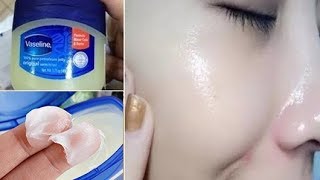 Vaseline কে এইভাবে ব্যবহার করলে মাত্র ৭ দিনে পাবেন স্থায়ীভাবে ফর্সা ত্বক চমৎকারী উপায় [upl. by Schell]