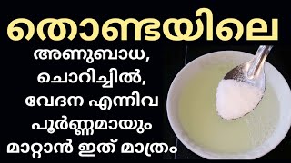 തൊണ്ടയിൽ ഉണ്ടാകുന്ന അണുബാധ തൊണ്ടയിലെ മറ്റു അനുബദ്ധ അസുഖങ്ങൾക്ക് ഇത് മാത്രം മതി  Throat Infection [upl. by Alah270]