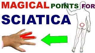 Sujok Therapy For SciaticaSujok Points For SciaticaSujok Acupressure Points For Sciatica [upl. by Atiras]