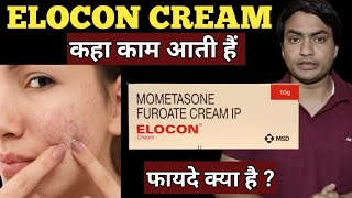 elocon cream  for dark spots  ke fayde  kaise use kare  use in hindi [upl. by Reifnnej446]