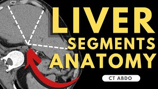 Liver Segments on CT scan  Radiology anatomy part 1 prep  Segmental Liver Anatomy CT [upl. by Luhey]