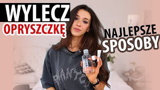 JAK POZBYĆ SIĘ OPRYSZCZKI najlepsze sposoby❤️ DZIAŁA [upl. by Nella]