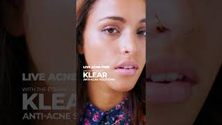 Live acnefree with Klear™ AntiAcne Solutions [upl. by Dare]