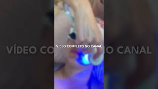 Vídeo completo do tratamento no canal limpezadepele facial estetica [upl. by Magnolia]