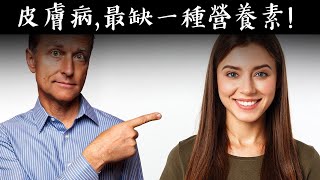 皮膚炎等皮膚問題，都缺一種營養素？自然療法柏格醫生 Dr Berg [upl. by Fasa505]