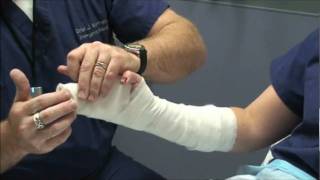 Splint Workshop 3  Ulnar Gutter Splint [upl. by Akenahs891]