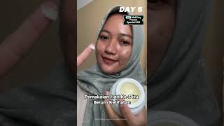 skincare fyp skincareroutine [upl. by Maillij]