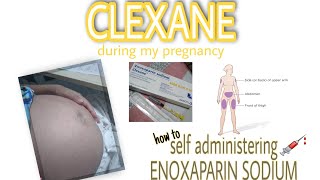 HOW TO INJECT CLEXANE AT HOME  Clexane during my pregnancy [upl. by Fraze]