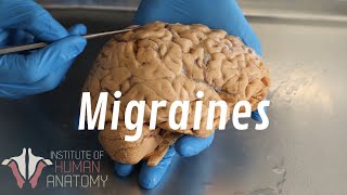 What Are Migraines [upl. by Howland]