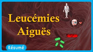 🎗️ Leucémie Aigue 🩸  symptômes🤧 traitements💉  Résumé  Hématologie [upl. by Nolos]