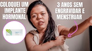 COLOQUEI UM IMPLANTE HORMONAL E QUASE DEU ERRADOMÃE COM NANISMO [upl. by Suilmann113]