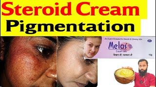 Steroid cream Side effect on face  Pigmentation कैसे ठीक करें ॰॰ Dr Prateek chauhan [upl. by Wendell]