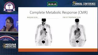 PSNM 2024  PETCT Imaging in Hematological Malignancies  Riffat Hussain [upl. by Kenwee]