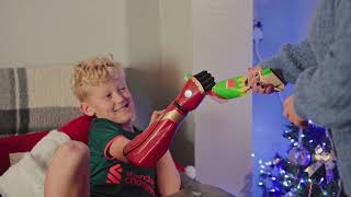 10year old pulls a Xmas cracker first time with new bionic arm [upl. by Naggem]