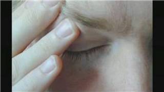 Headache Treatments  Migraine Homeopathic Treatments [upl. by Kathryne]