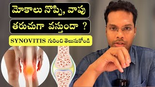 Knee pain amp swelling  Synovitis  Main causes in Telugu  Dr Ramprasad Kancherla [upl. by Hound]