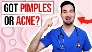 How to get rid of pimples overnight and acne [upl. by Craven]