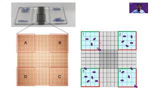 Counting cells on a hemocytometer [upl. by Henigman209]