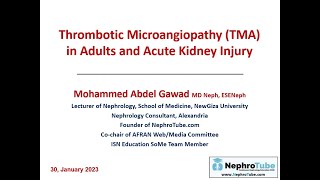 Thrombotic Microangiopathy TMA in Adults and Acute Kidney Injury  Arabic Language  Dr Gawad [upl. by Elysia672]