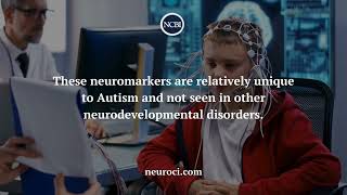 The Use of Neuromarkers in Diagnosing Autism [upl. by Harehs]