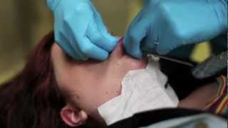 6g labret piercing procedure [upl. by Adiel190]