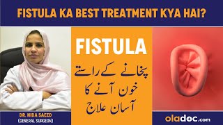 Fistula Ka Best Treatment Kya Hai  Bhagandar Ka Ilaj  What Is PeriAnal Fistula  Fistula Symptoms [upl. by Colas]