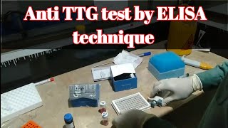 Procedure of Anti TTG tissue transglutaminase test IgG amp IgA by Elisa Technique [upl. by Jegar726]