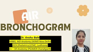 Air Bronchogram Chest X Ray Pediatrics Radiology Dr Anshus MBBS Lectures [upl. by Valaria]