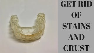 How To Clean Your Retainers [upl. by Akemed]