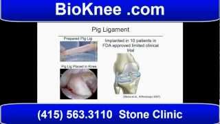 Best Knee Replacement Surgeons and Doctors [upl. by Atsok]