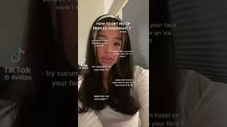 how to get rid of pimples overnight  notmine tiktok tips4u [upl. by Ollayos879]