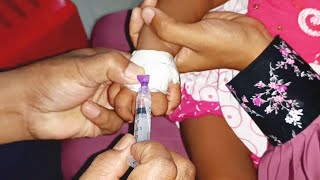 Meropenem injection Cannula  Child  তে Push 24 Ep 39 By Injection Tv [upl. by Alidus750]