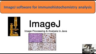 ImageJ software for immunohistochemistry analysis [upl. by Bertle]