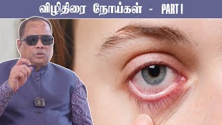 விழித்திரை நோய்கள் Part I  Retinal Diseases Part I [upl. by Easlehc89]