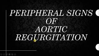 SIGNS OF AORTIC REGURGITATION with videos for all signs [upl. by Znieh204]