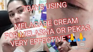 MELACARE CREAM 7DAYS USING EFFECTIVE MELACARE CREAM FOR MELASMA OR PEKAS 🙏🙏LEGIT USER [upl. by Ennayt]