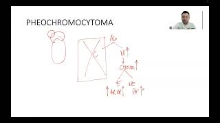 ENDOCRINE PHEOCHROMOCYTOMA [upl. by Yauq]