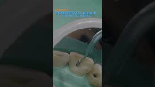 Essentials in endodontics ULTRA X eighteeth [upl. by Ahs]