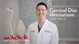 Understanding Cervical Neck Disc Herniations  Dr Kevin Ju  Spine Surgeon  Rockwall TX [upl. by Sehcaep917]