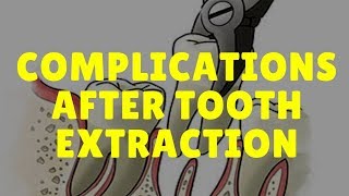 Complications After Tooth Extraction Symptoms amp Treatment Fast Relief [upl. by Hannej182]