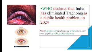 What is trachoma the eye disease eliminated by India  upsc current [upl. by Yendirb]