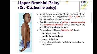 erbs palsy upper limb anatomyfcps part1 preparation forumcpsp favorite BCQUES [upl. by Winchell786]