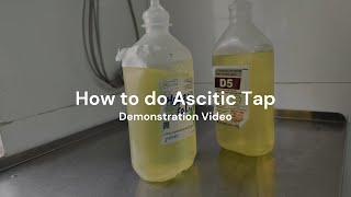 Paracentesis  How to perform Ascitic Tap [upl. by Garbe]