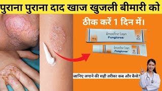 fungicros cream uses in hindi  amorolfline cream fungicros लगाने का सही तरीका जानिए। [upl. by Carolin]