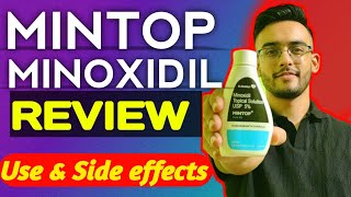 Mintop 5 Minoxidil ReviewSide effects of minoxidil [upl. by Alamat]