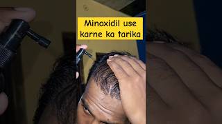 How to use minoxidil shorts shortsfeed viralshort minoxidil Sanjusawan1 [upl. by Wallas435]